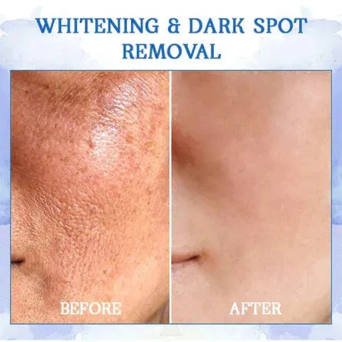 Fubsta™ Advanced Skin Tightening Rejuvenating Cream ( BUY 1 GET 1 FREE )⭐️⭐️⭐️⭐️ 4.9/5 Reviews