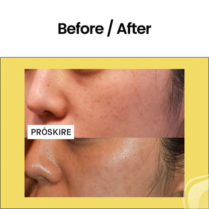 20% Advance Vitamin C Face Serum for Korean Skin 30ml | BUY 1 GET 1 FREE | ⭐️⭐️⭐️⭐️ 4.9/5 Reviews