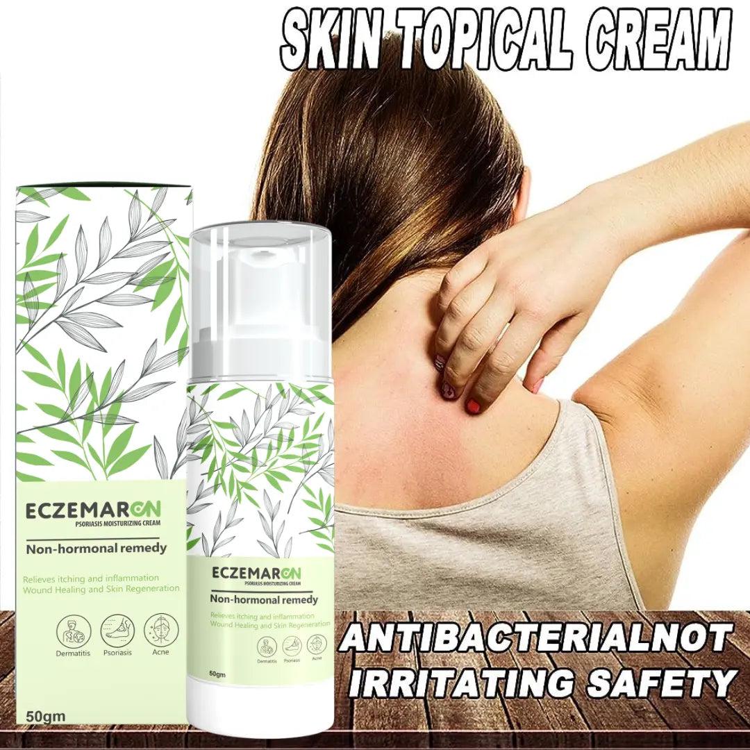 Eczemaron Anti Fungal Cream 50gm | Buy 1 Get 1 Free | ⭐️⭐️⭐️⭐️ 4.9/5 Reviews